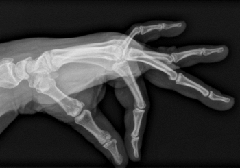 Radiographie
